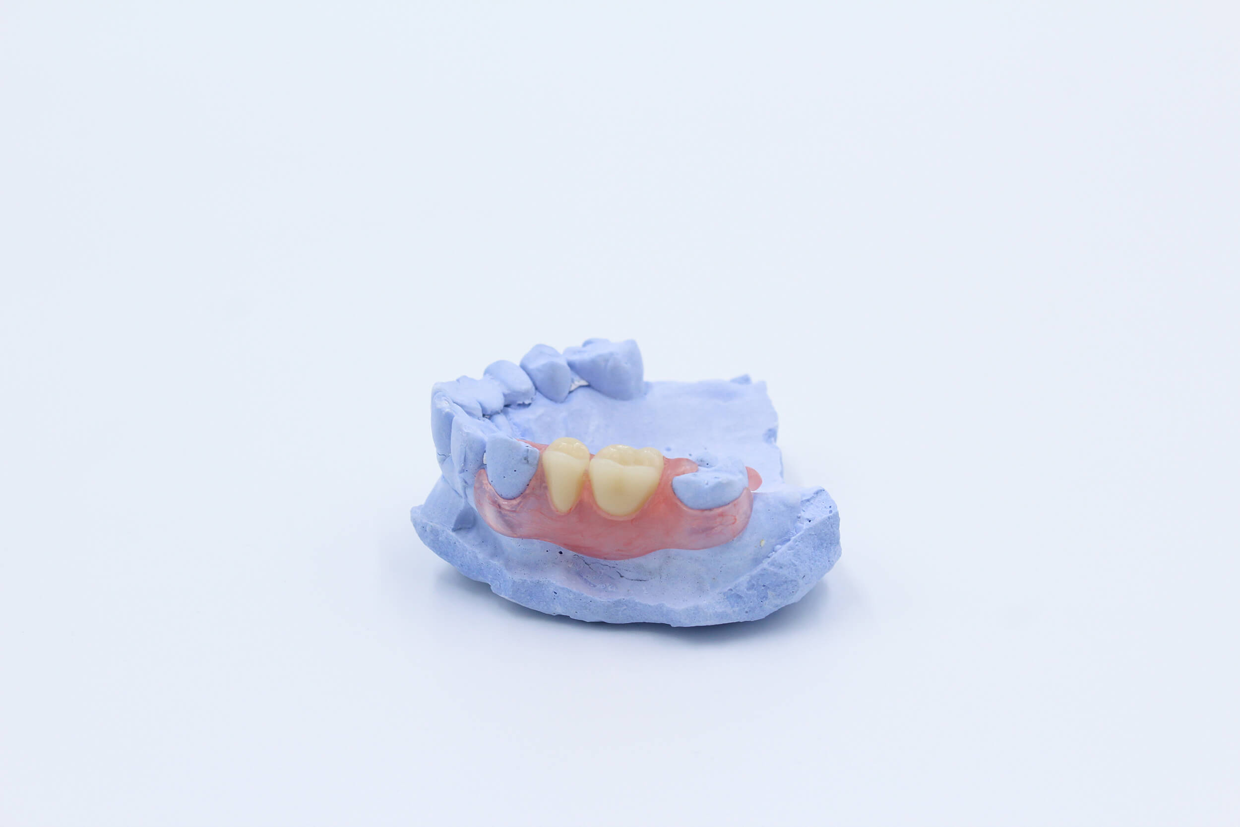 coronas-dentales-clinik-tj