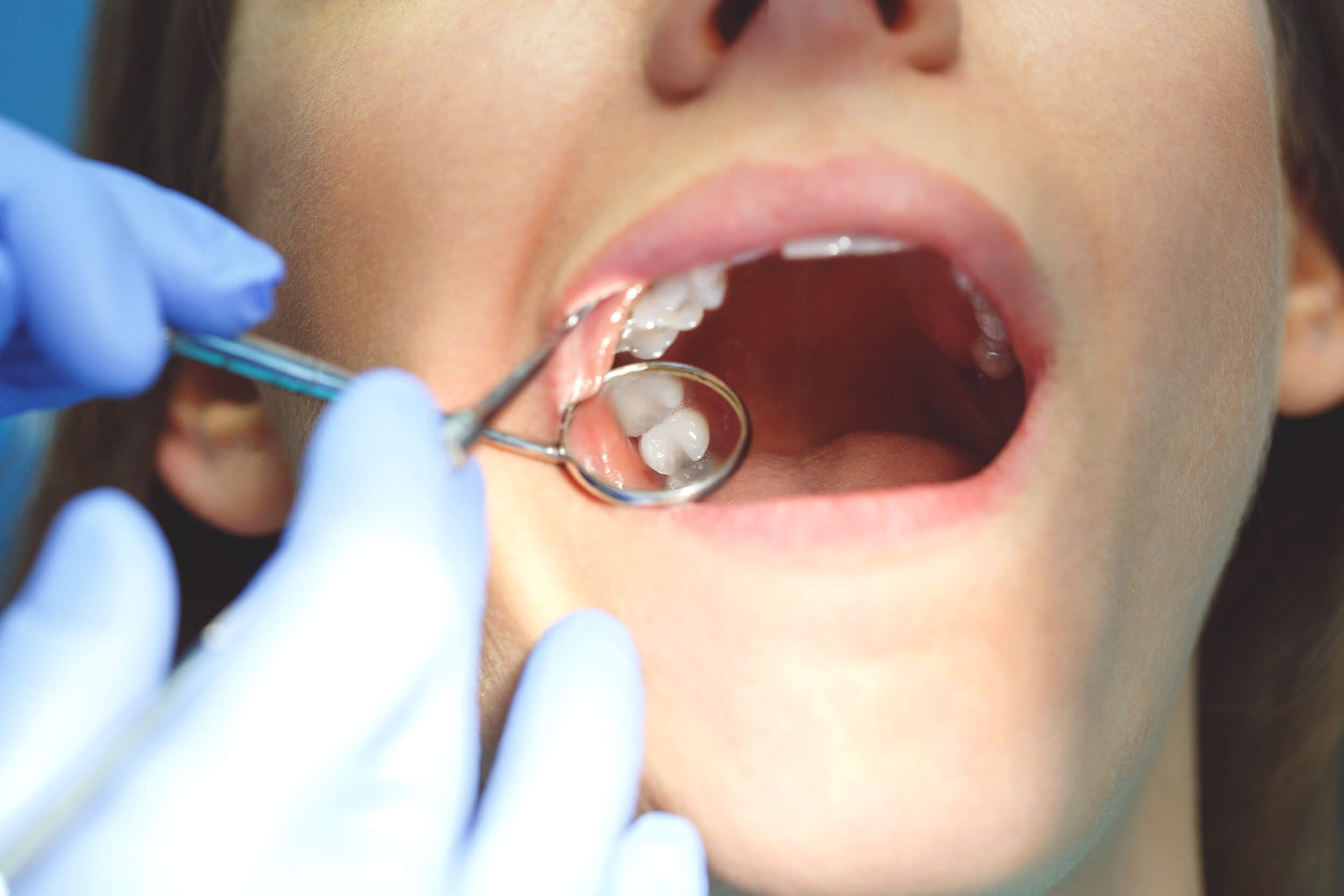endodoncia-en-tijuana-clinik-dental-tj